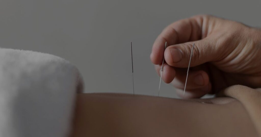 Coral Gables Acupuncture in Miami