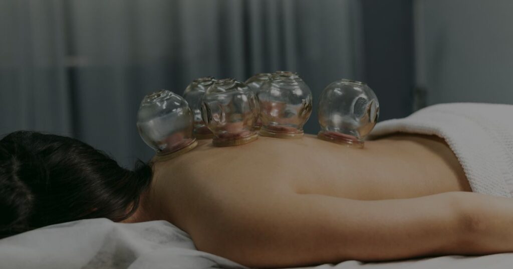 Coral Gables Cupping Therapy