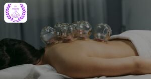Coral Gables Cupping