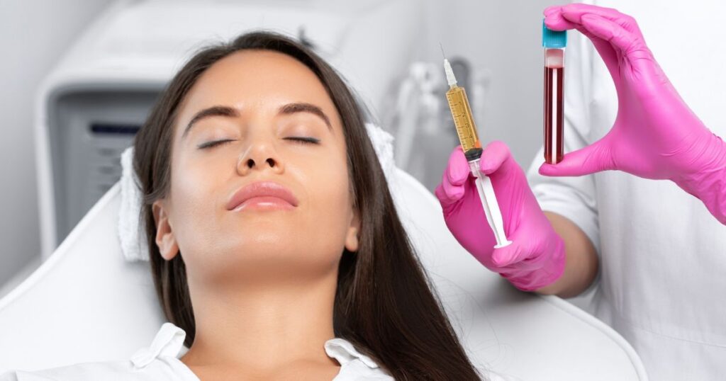 platelet rich plasma (PRP)