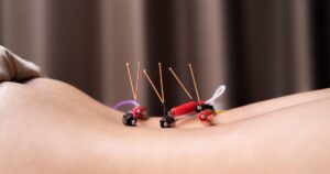 acupuncture benefits for fertility