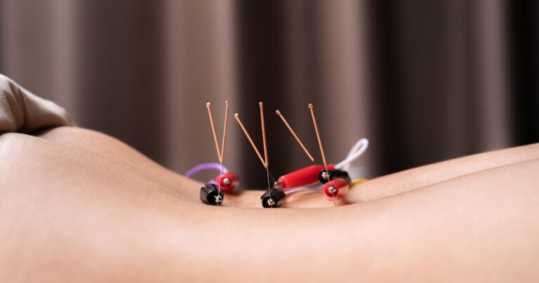 acupuncture benefits for fertility