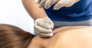 acupuncture for women’s health in miami