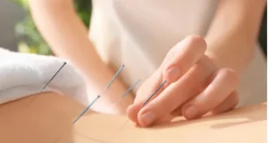 Acupuncture Supports Natural Detox